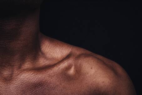 Il dolore osteomioarticolare: cervicalgia e disturbi della spalla